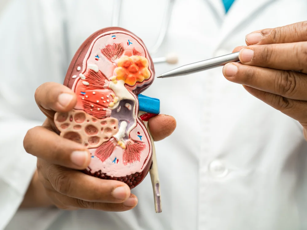 Kidney Disease
